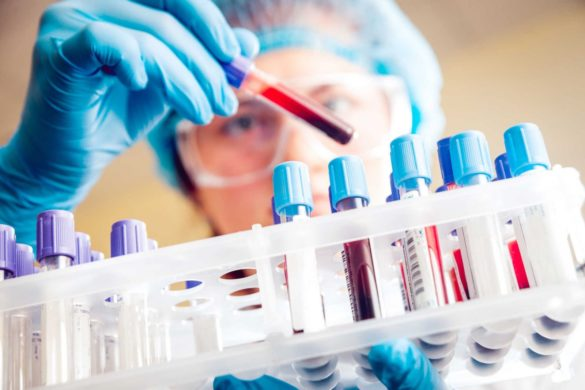 Xét nghiệm Vi sinh – huyết thanh học để phát hiện sự có mặt của virus viêm gan