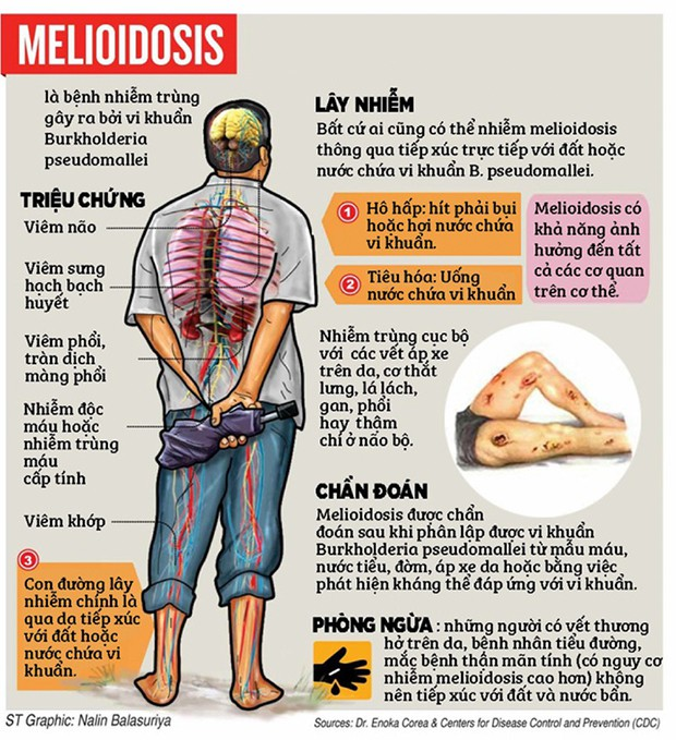 Đặc điểm của bệnh Melioidosis