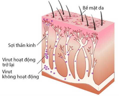 Vị trí hoạt động của virus gây bệnh Zona thần kinh