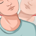 Tiếng rắc khi xoay cổ có nguy hiểm không?