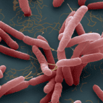 bệnh melioidosis hay bệnh whitemore