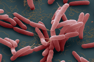 bệnh melioidosis hay bệnh whitemore