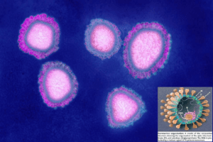 Viêm phổi do virus corona gây ra tại Trung Quốc