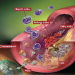 kiếm soát rối loạn mỡ máu