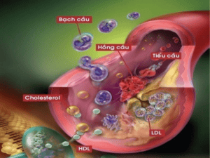 kiếm soát rối loạn mỡ máu