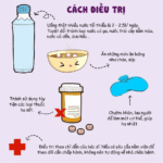 Điều trị sốt xuất huyết