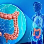 Hội chứng ruột kích thích là gì?