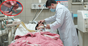 Ngộ dộc mật cá trắm (Hình ảnh minh họa)