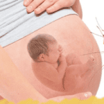 Sốt xuất huyết ở phụ nữ mang thai