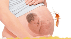 Sốt xuất huyết ở phụ nữ mang thai