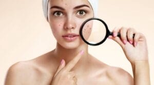 Sai lầm trong điều trị mụn trứng cá