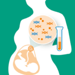 Sàng lọc trước sinh