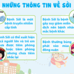 Những điều cần biết về bệnh sởi