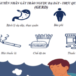 trào ngược dạ dày nguyên nhân