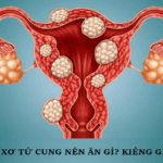 U xơ tử cung nên ăn gì kiêng gì