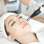 ứng dụng laser trong lam đẹp