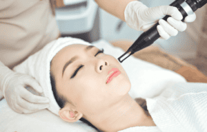 ứng dụng laser trong lam đẹp