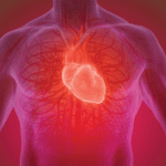 Viêm cơ tim là gì?