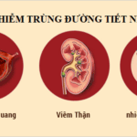Viêm đường tiết niệu