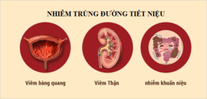 Viêm đường tiết niệu