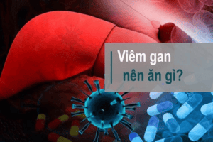 Viêm gan nên ăn gì? Kiêng gì?
