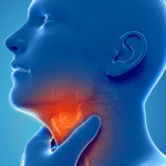 mùa hè bị viêm họng