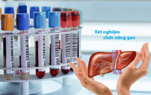Xét nghiệm chức năng gan